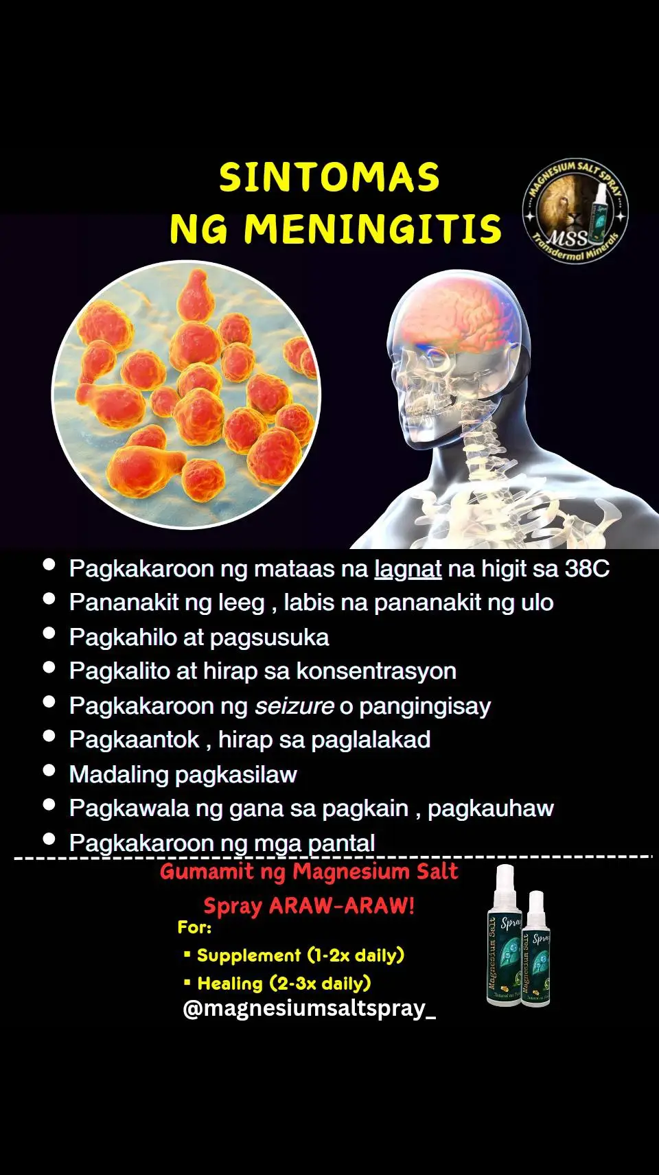 Ano nga ba ang MSS o MAGNESIUM SALT SPRAY? Ito ay pinagsama-samang nga MINERALS,pangunahin ang MAGNESIUM, na inilagay sa isang bote at ipinapahid lang sa BALAT o sa apektadong bahagi,NAPAKALAKI ng kinalaman ng pagkakaroon ng ibat-ibang karamdaman kapag NAWAWALAN ng SAPAT na MINERALS o kaya hindi ito balanse, kaya kapag nabigyan mo ng sapat na minerals ang katawan mo kusang magsisiwalaan ang mga nararamdaman dahil naa-ACTIVATE nito ang NATURAL HEALING MECHANISM,lalo Kong masasabayan ng iba pang mga bitamina lalo ng mayaman sa Bvitamins o Bcomplex,at SAPAT na inom ng tubig,tulog at ehersisyo at makapag paaraw, alisin ang galit sa puso, piliin laging sumaya. Ang kahit anong karamdaman ay maaring GUMALING kapag naibigay mo ang kakailanganin ng iyong katawan. #MSS  #allinone #miraclespray  #NATURALnaPANLUNAS  #MAGNESIUMsaltSPRAY  #naturalnapanlunasadvocate  #pisikpisiktanggalangmgasakit  #TRANSDERMALmineralSUPPLEMENT  #foryou #health #magandangprodukto #keepsafe 