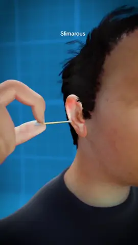 #ear #cleaning #qtip #earwax #learning #proper 