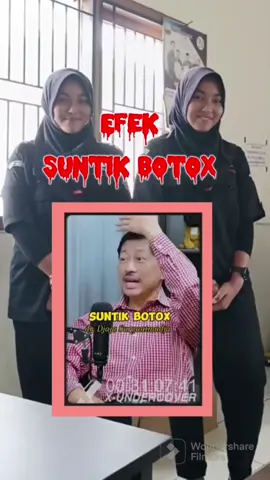 Efek Suntik Botox || dr. Djaja Suryaatmadja #botox #SehatAlami #top #fypシ #viralillill #trending #viralil #dokter 