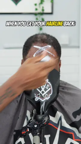 Did i save his hairline?!! #toupee #hairunit #hairsystem #fyp #barber #londonbarber #haircut 