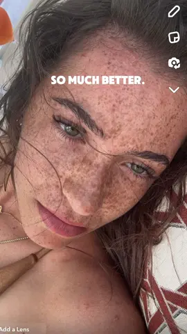 I cant wait for my summer freckles 😩 @Kosas 