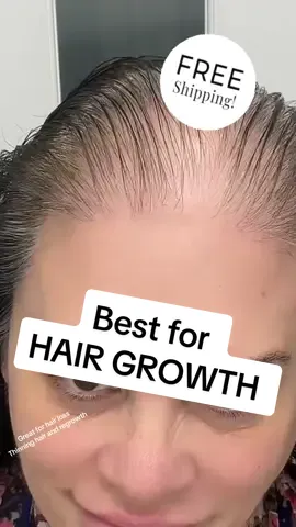 These itemas are amazing for hair loss. All natural sakt free shampoo and conditioner plus Rosemary oil. #hairloss #hairgrowth #thinninghair #malepatternbaldness #covidhairloss #hormonalhairloss #rosemaryoil #rosemaryoilforhairgrowth #ayurveda #amla #murumuru #hyaluronicacid #aloevera #saltfree 