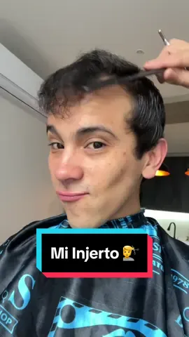 Hace 1 año me hice mi Injerto Capilar en @TranspelMx y no podría estar más contento! 😊  En este video puedes ver los resultados, pero si quieres saber más sobre el procedimiento, te dejo otro en dónde explico más detalles en los comentarios. Abrazo de magia! 🙌🏻🪄 #transplantedecabello #publicidad