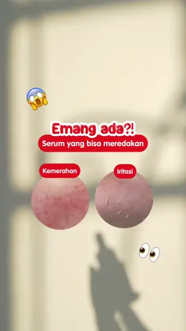 Emang ada serum yang bisa meredakan kemerahan dan iritasi sekaligus?😱👀 #PigeonTeensIndonesia #SkincareRemaja #CalmFairySerum #Serum 