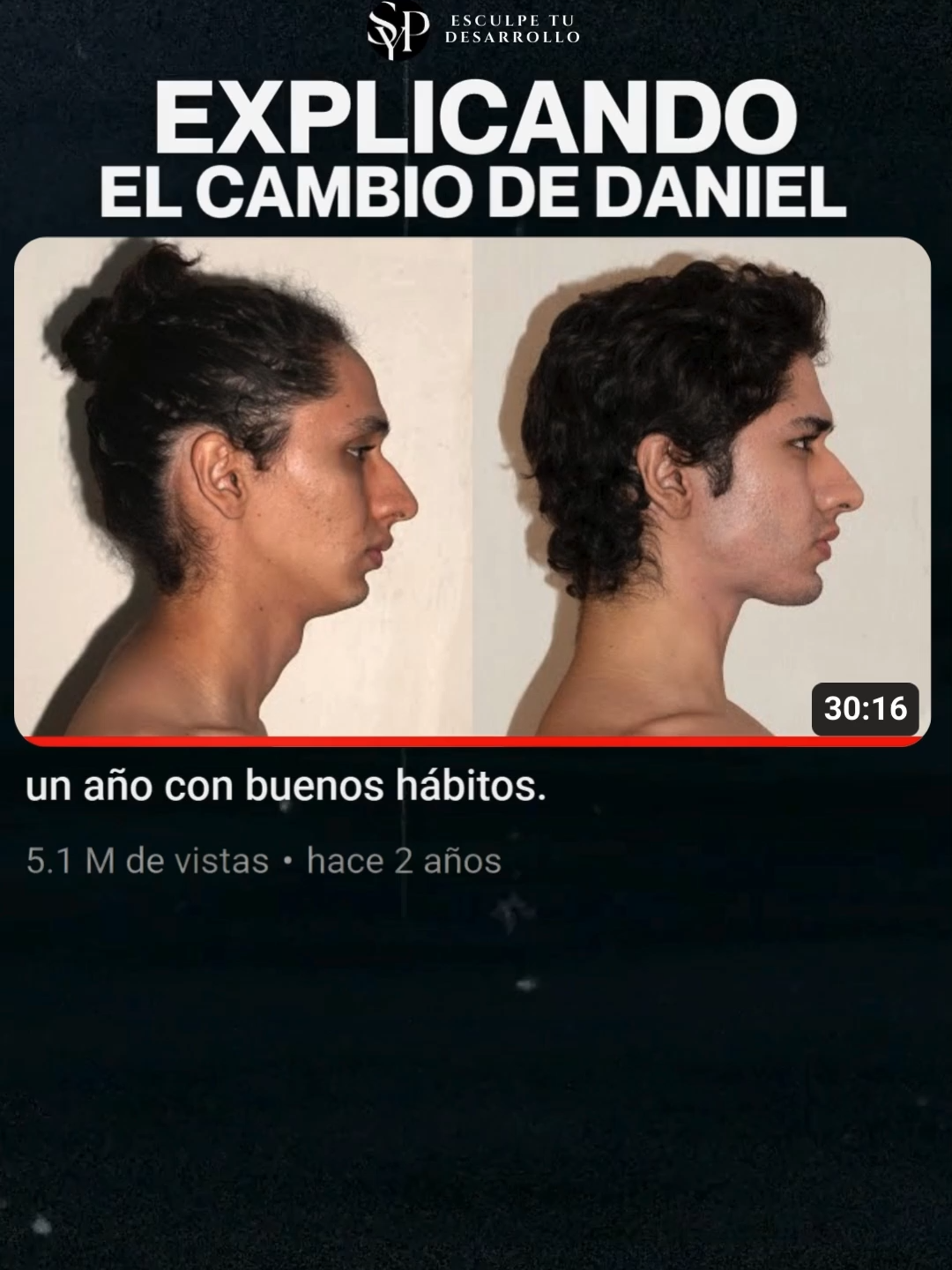 El cambio facial de Daniel Llamas. Aquí las redes sociales de los miembros del video.  @nosexgod_  @syrianpsycho  @joaoluzx