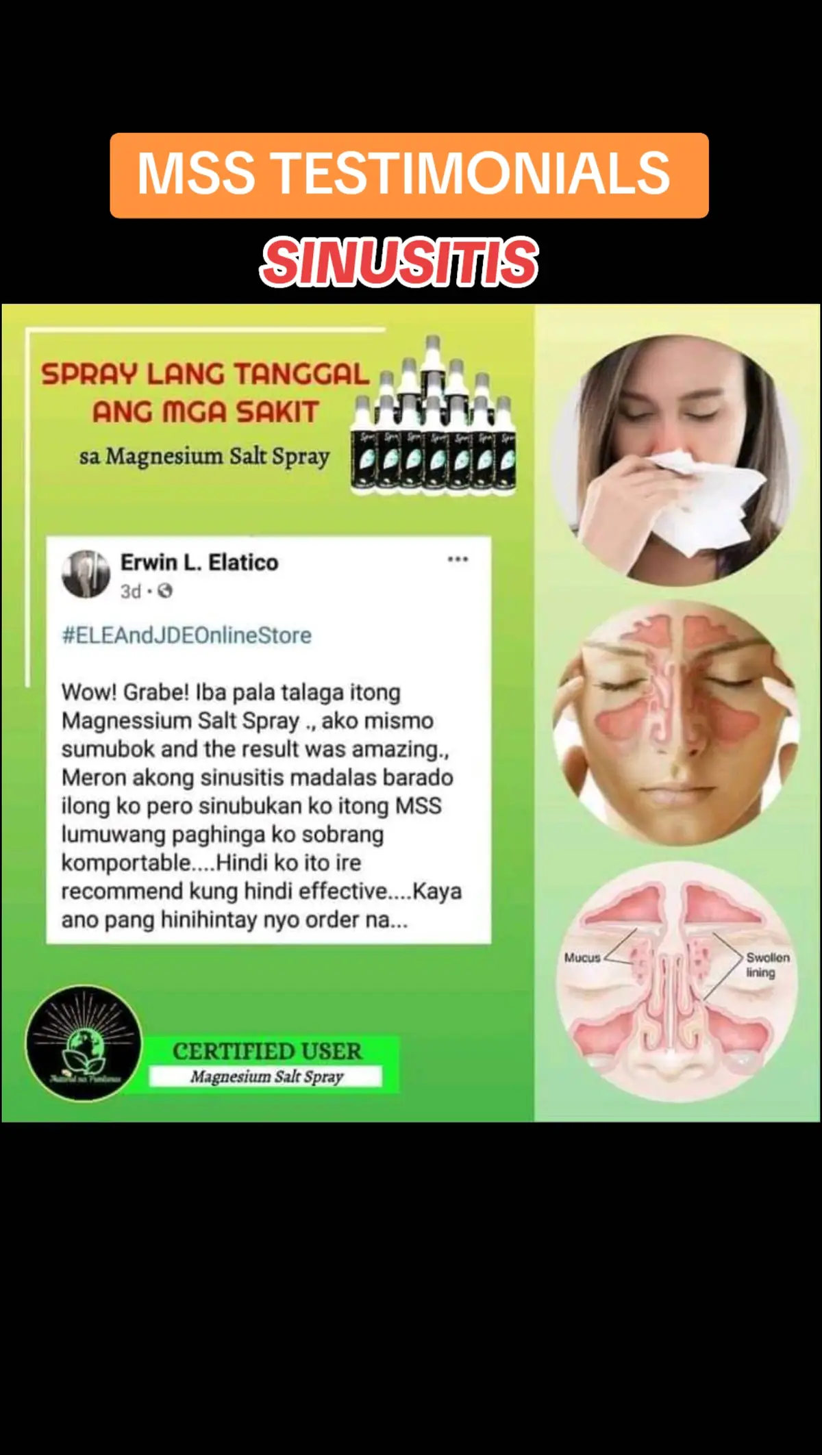 Ano nga ba ang MSS o MAGNESIUM SALT SPRAY? Ito ay pinagsama-samang nga MINERALS,pangunahin ang MAGNESIUM, na inilagay sa isang bote at ipinapahid lang sa BALAT o sa apektadong bahagi,NAPAKALAKI ng kinalaman ng pagkakaroon ng ibat-ibang karamdaman kapag NAWAWALAN ng SAPAT na MINERALS o kaya hindi ito balanse, kaya kapag nabigyan mo ng sapat na minerals ang katawan mo kusang magsisiwalaan ang mga nararamdaman dahil naa-ACTIVATE nito ang NATURAL HEALING MECHANISM,lalo Kong masasabayan ng iba pang mga bitamina lalo ng mayaman sa Bvitamins o Bcomplex,at SAPAT na inom ng tubig,tulog at ehersisyo at makapag paaraw, alisin ang galit sa puso, piliin laging sumaya. Ang kahit anong karamdaman ay maaring GUMALING kapag naibigay mo ang kakailanganin ng iyong katawan. #MSS  #allinone #miraclespray  #NATURALnaPANLUNAS  #MAGNESIUMsaltSPRAY  #naturalnapanlunasadvocate  #pisikpisiktanggalangmgasakit  #TRANSDERMALmineralSUPPLEMENT  #foryou #health #magandangprodukto #keepsafe 