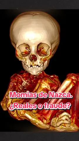 Empezamos con el debate con este tema que dió y aún da mucho de que hablar entre la comunidad científica. ¿Son reales las momias de Nazca? ¿Tu que opinas? #viral #parati #fyp #Podcast #paranormal #podcastparanormal #paranormalpodcast #momia #nazca #momiasdenazca #ciencia #avatar #extraterrestres #alien 