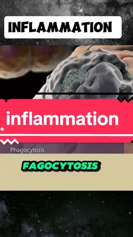 Inflammation immune response to tissues injury or infections  #disease #medicineexplained #medicine #medicalknowledge #inflammation #infection #tissues #injury 