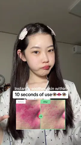 Ive been testing purito seoul centella unscented serum for a month and im loving it so far!😍#purito #centellaserum #serum #skincalming #acne #acnejourney @Purito Seoul 