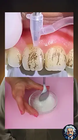 RECETA NATURAL PARA BLANQUEAR LOS DIENTES #dientesblancos #remediosnaturales #DIENTES #blanqueamientodental 
