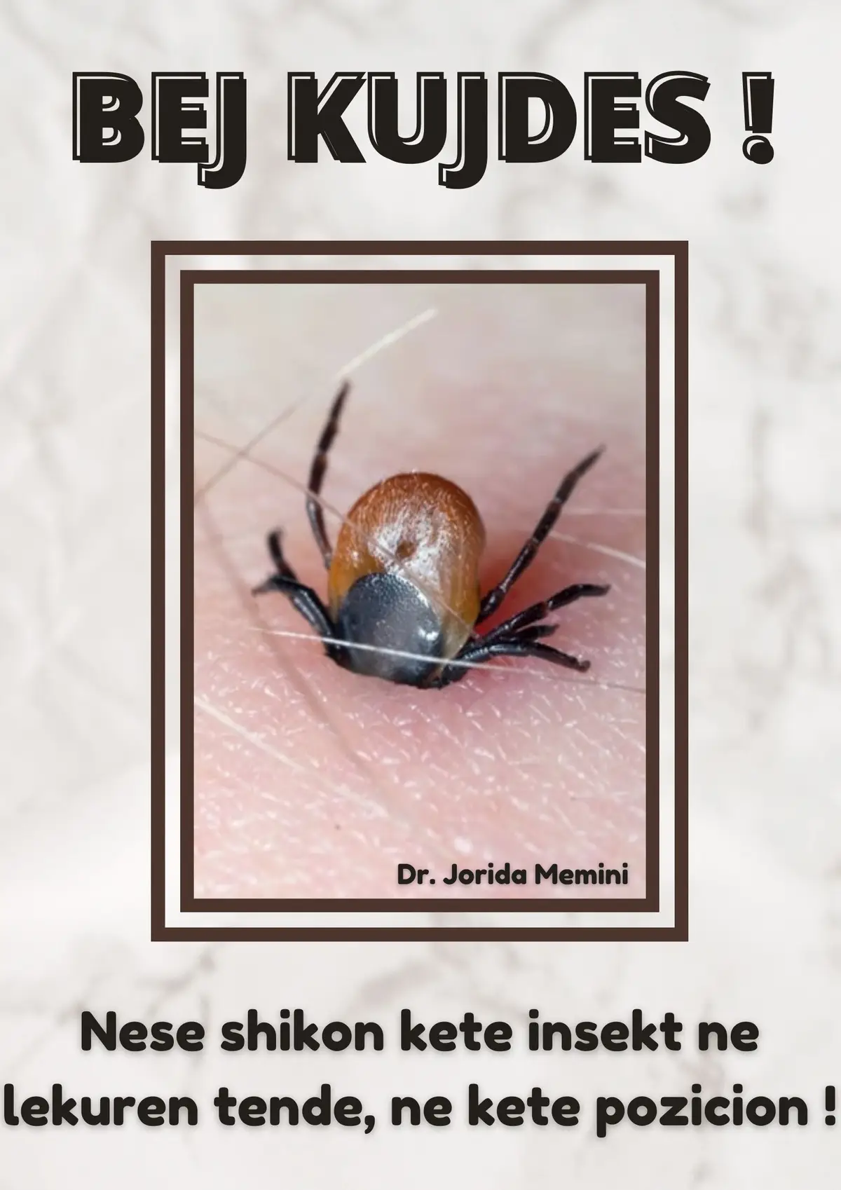 #lyme #disease #tick #dermatology #fyp 