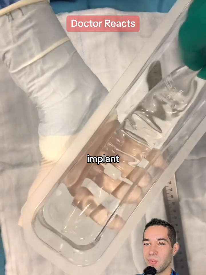 I'll bet you've never seen this kind of unboxing before #implant #medical #surgery #unboxings