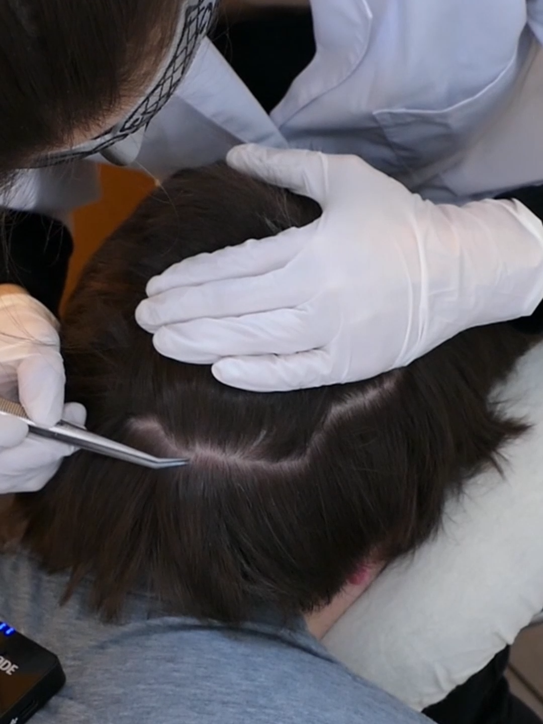 3 Minutes of ASMR School Nurse LICE Check on 2 Students but 1 INFESTED | Removal with Tweezers (Real Person) #asmr #asmrsounds #asmrvideo #asmrtiktoks #scalp #scalpcheck #asmrsensory #asmrroleplay #asmrmedical #asmrdoctorroleplay