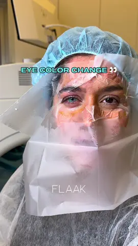 Eye color change using the FLAAK Pro technique, the most advanced and natural keratopigmentation. On the advice of New Color, Beatriz🇧🇷 chose the Water Green color, surgery took place in Roma 🏛️🇮🇹 You dream about changing the color of your eyes? Send us a PM💌 #newcolor #flaak #keratopigmentation #ceratopigmentcao #cheratopigmentazione #eyecolorchange #eyes #eye