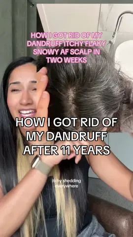 How i got rid of my dandruff after 11 years of trying sooo many products! This one has finally kept it at bay for > a month! Do i think it will last forever? Probsbly not, but this month has been the best month ever 😭 i was so used to doing certain things because of it, like not wearing black, having to put my hair up, having to wash last minute, having to take pics of the back of my head to see whats going on😩 wiping off the couch / WORK seat of my dandruff 😭😭 fr my coworkers must know its dandruff 😭 and fhen when someone says oh you have somethijg in your hair, let me get it 😳 no Tf you aint!!!!  Anyways, us dandy girls gotta stick together 🫶 i hope this works for you as it has for me, even if its just temporary ❤️  @Vichy Laboratoires  #dandruff #dandruffsolution #itchyscalp #dryscalp #scalptreatment 