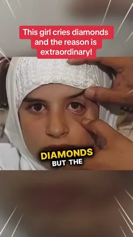 This girl cries diamonds but the reason is extraordinary! #truestory #LearnOnTikTok 