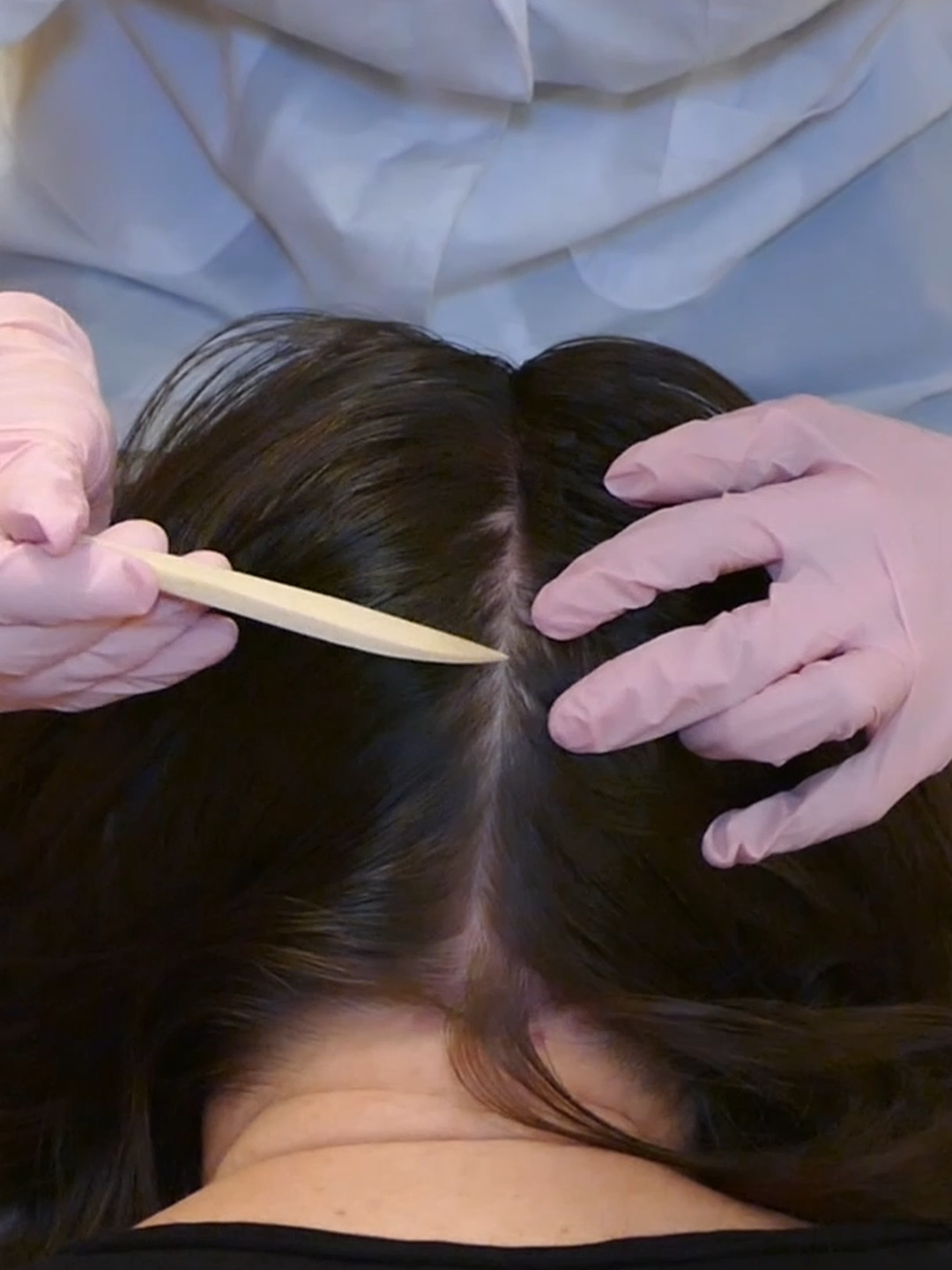 ASMR Detailed Scalp EXAM and TREATMENT (Real Person) #asmr #asmrsounds #asmrvideo #asmrtiktoks #scalp #scalpcheck #asmrsensory #asmrroleplay #asmrmedical #asmrdoctorroleplay