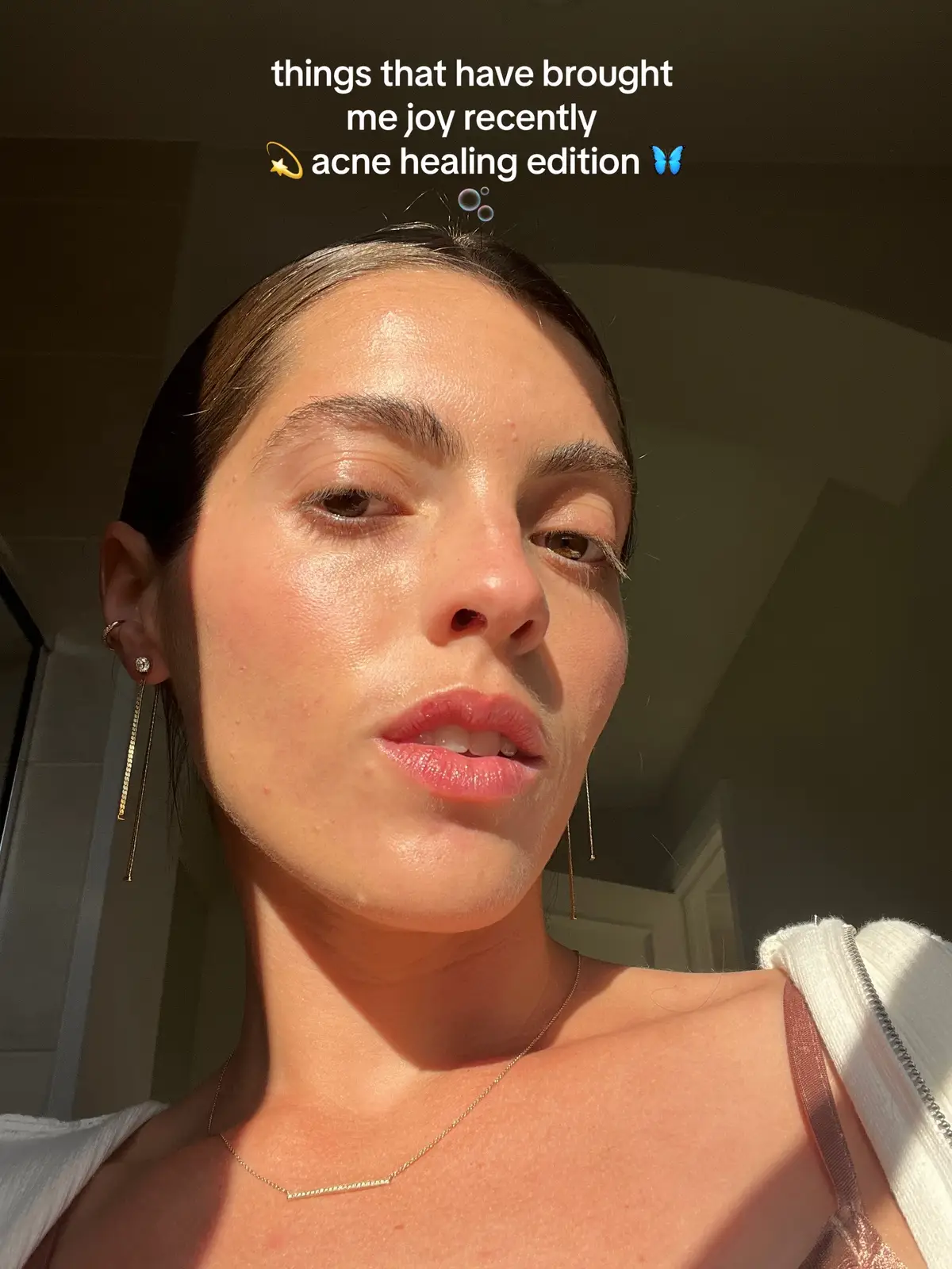 #skinjourney #skinhealing #skinhealth #acnejourney #acnescars #acneskin #acnefighter #acneskincareroutine #accutanejourney #accutane #accutanejourney #photodump @Kiehl’s Since 1851 @AquaphorUS @Crown Affair 