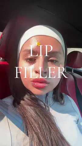 Will a lip flip help ? #lipflip #lipfiller #topteeth 