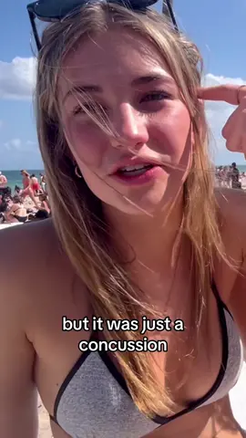 “It was just a concussion” 😂 #fyp #viral #springbreak #collegegirl #college #crazystory #fortlauderdale #fortlauderdalebeach 