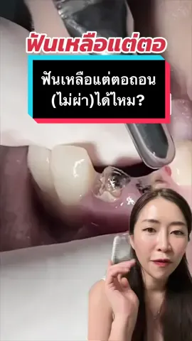 ตอบกลับ @ningning68 ฟันเหลือแต่ตอถอน(ไม่ผ่า)ได้ไหม? #หมอณัฐคุณ #คลินิกทันตกรรมทูธลักค์ #toothluck #ทําฟันขอนแก่น #ทําฟันmrtแยกติวานนท์ #ถอนฟัน #รักสุขภาพ #tiktokuni #tiktokสายความรู้ #รู้จากtiktok #กรีนสกรีนวิดีโอ #กรีนสกรีน 