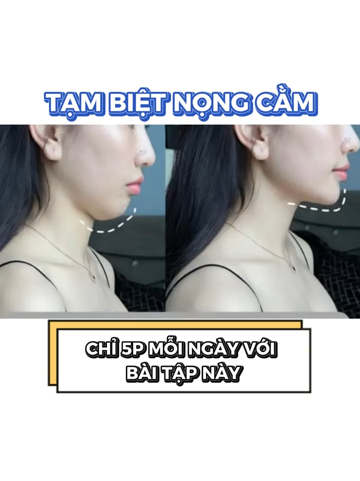 Lưu ngay bài tập nếu muốn mặt thon gọn hết nọng cằm #ibone #ibonefisio #baitaptainha #matlech #tmj #vairal #xuhuong