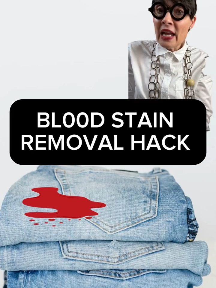 Here's an #easy & #natural bl00d stain removal #hack#stainremover