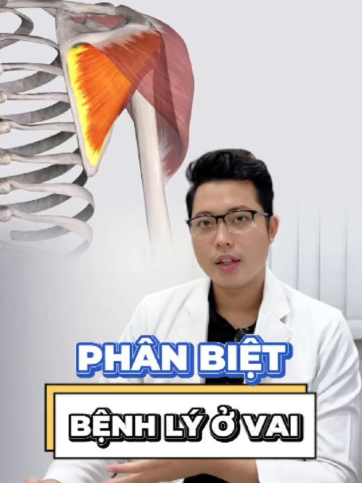 Phân biệt bệnh lý ở vai #ibonefisio #ibonefisioviencoxuongkhop #dauvai #coxuongkhop #chiropractic