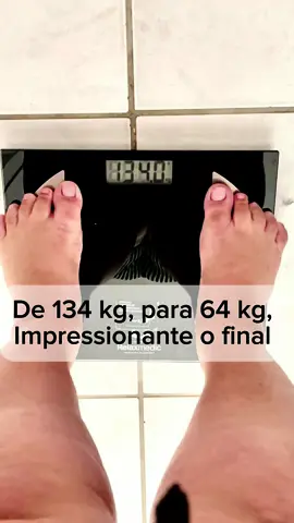 Mais um pouco da minha história para vocês !! Sempre com informações novas e conteúdos novos que vou soltando aos poucos !!!  Me acompanha nessa nova vida 😍😍😍 @farmacia_manipula @fabricioaraujopersonal @aimperiofitness @dralorenabianchi @eliethpadovaninutri @dr.eneascortes  #bari #bariatrica #bypass #sleeve #bypassgastrico #emagrecimento #emagrecimentosaudavel #emagrecercomsaude #antesedepois #antesedepoisemagrecimento #plasticareparadora #retiradadepele 
