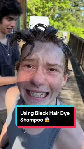 This is the result of using Hair Dye shampoo 😱