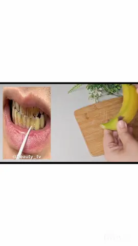 #Secret that Dentists don't want you to know: Teeth Whitening in just 2 minutes🦷#Secret #treth #teethwhitening #teethcare #teethcleaning #teethcare #teethingbaby #teethbeauty #teethbeautyroutine #viralvideo #teethbeauty #viraltiktok 