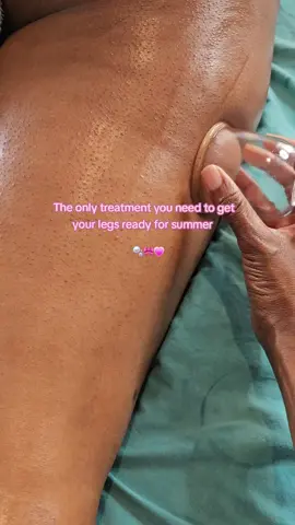 Ready to say goodbye to cellulite and hello to summer-ready legs? Vacuum therapy is all you need for smooth, sculpted skin! 🌟💪 #CelluliteTreatment #SummerReady #VacuumTherapy #bodytreatment 