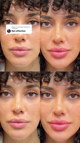 Replying to @Sumaya Rahman Micro-needling is a proven method that stimulates collagen production in your lips 👄 causing increased volume, skin renewal, and plumpness. Collagen building processes are stimulated through Micro-injuries creating by the 0.5 mm lip roller. This method is used by dermatologists & estheticians 🙌 We crafted an at-home version that works & gives you the same SEMI-PERMANENT Results 😍 #collagenproduction #lipplumping #lipplumper #lipplump #lipfiller #antiagingskincare #antiagingtips #poutify #trypoutify #collagen 