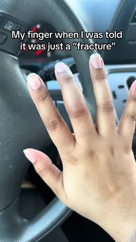 such a roller coaster 😭🎢 #giantcelltumor #fingeramputation #amputee #rayamputation #amputation 