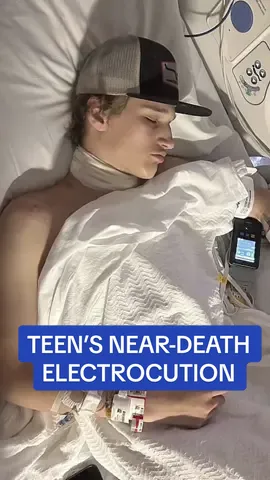 Rayce Ogdahl was left with second, third and fourth degree burns after ripping the chain off.  Doctor’s also told Rayce’s family that he’d experienced enough amps to kill him.  📸 Kennedy News and Media  #chain #necklace #teen #teenager #scary #electric #oklahoma #oklahomacity #cross #hospital 