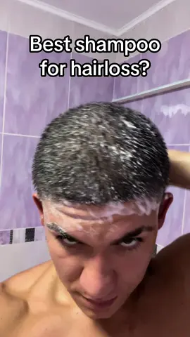 Best shampoo for genetic hairloss! #bestshampoo #ketoconazole #stophairloss #hairtok #ketoconazole #ketoconazoleshampoo #fyp