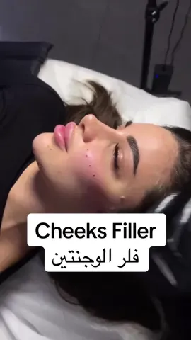 Amazing results with the work of our wonderful doctor 🌸 The face is examined by our specialist doctor, and we do everything according to the patient’s wishes to give him satisfactory results✨❤️ Many people around the world choose us, so we are distinguished by our work🙏 ✅Contact us for book appointment  Arabic/ English : +905521708610 Türkçe : +905070868610 Türkçe: +905521728610 . . . . #foryou #istanbul #mesotherapy #botox #skin #durraclinics #collagen #undereye #naturallipsfiller #lipsfiller #facelifting #naturallipfiller #russianlips 
