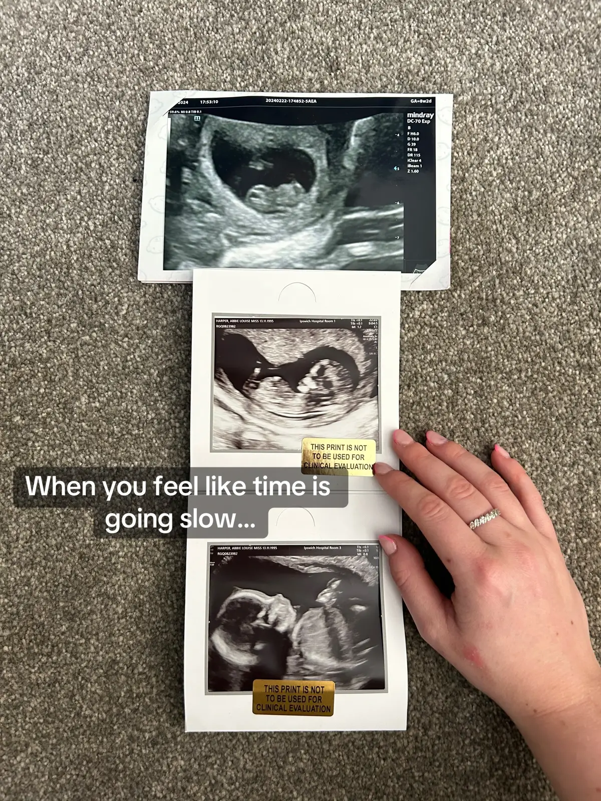 Finding out super early, it did make my first trimester feel so slow! Although the weeks seem to be flying by now.  Would love to know how far you are or when you’re due! Comment below 🥹💛  #pregnancy #fyp #secondtrimester #pregnant #20weekspregnant #2024 #mumtobe 