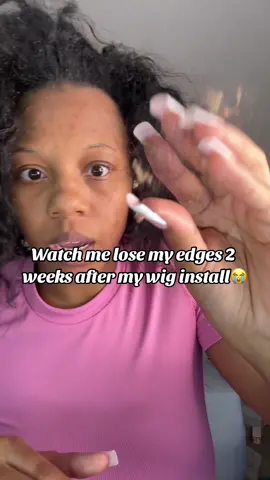 Thank goodness for the glue solvent i had😩😭 #joniaalillian #wigremoval #badhairday #hairloss 