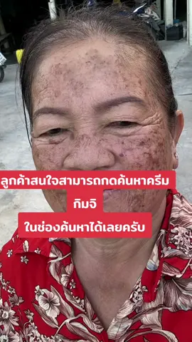 #เทรนด์วันนี้ #ครีมกิมจิ #ครีม #บํารุงผิวหน้า #ออร่า #ติดสาร #ผิวพรรณกระจ่างใส #จุดด่างดํา #รอยดํา #ฝ้า ​ #สิว #รอยแดง #กระ #ผิวหน้า #อย่าปิดการมองเห็น 