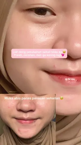 Facewash yang bikin bruntusan aku ga dateng lagi #facewashviral #fyp 