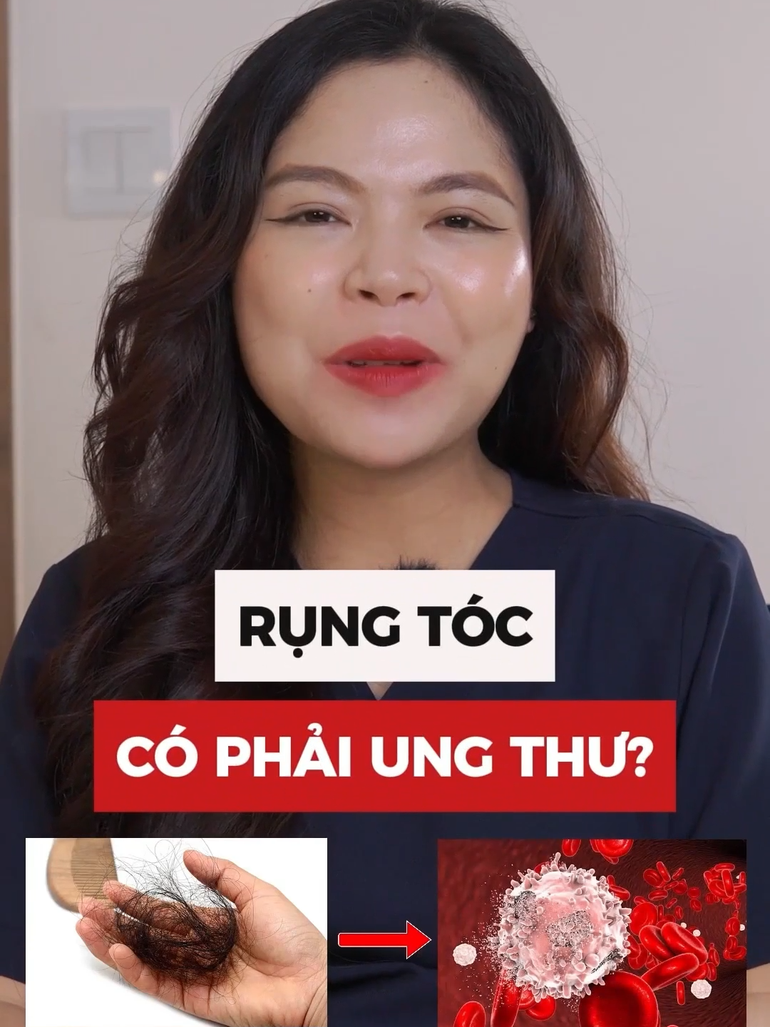 Rụng tóc là dấu hiệu của bệnh gì #bacsinguyen #bsnguyen