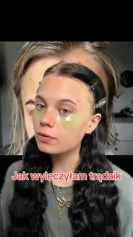 Pamietajcie nie jestem lekarzem to tylko rady ktore pomogly mi*