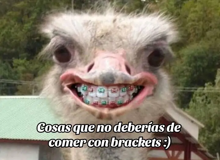 Estas son cosas que no deberías de comer con brackets :) #brackets #comida #bracketsdecolores #tiktok #vide #viral #videoviralitiktok #videoviral #videoviraltiktok #fyp #fypシ゚viral #noflop #noflopplease #tiktokponmeenparati #tiktokponmeenparatiporfa #pinchetiktokponmeenparati 