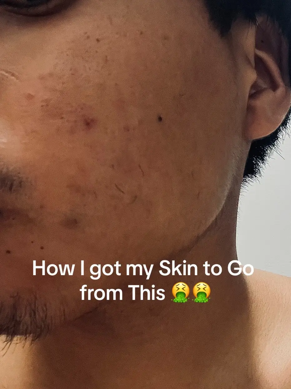 If you dont use these then you are missing out best SkinCare Right now to get Rid of Darkspot and clear up face #creatorsearchinsights  #skincare  #korean  #koreanskincare  #clearskin  #cleanser #trending #viral 