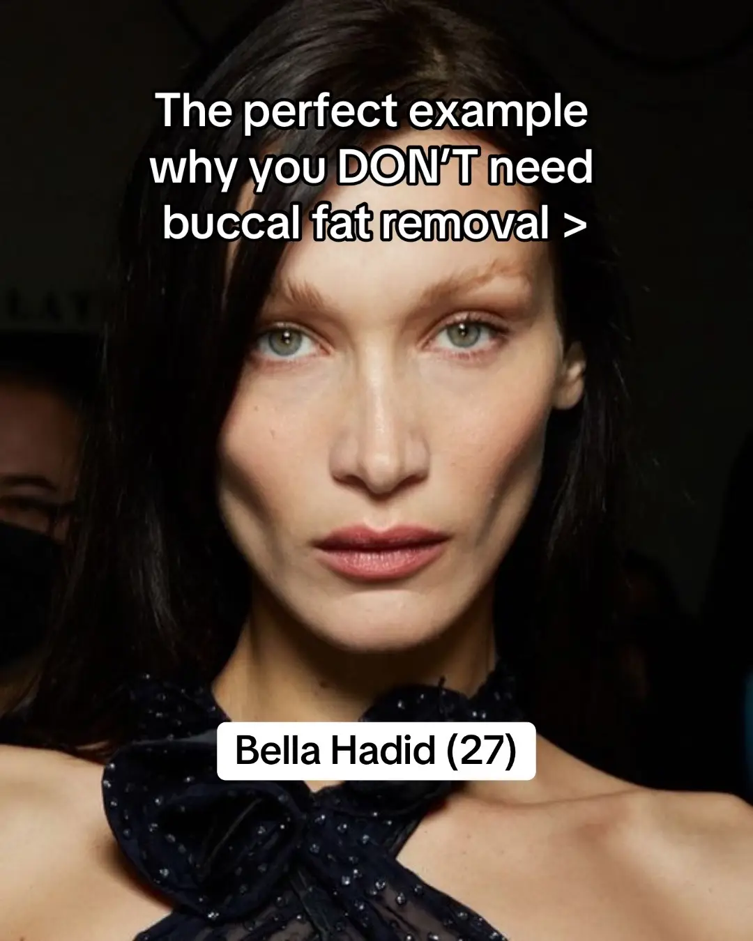 Looking INCREDIBLE at 37 ✨ Nicola Coughlan is the perfect example of how full, plump cheeks are a sign of youthfulness! #fyp #foryoupage #nicolacoughlan #bridgerton #bridgertonnetflix #popculture #trending #skincare #buccalfatremoval #bridgertonseason3 