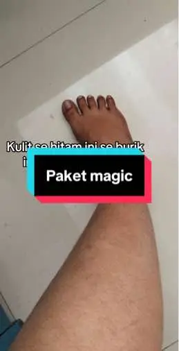 Paket magic semua ter atasi #resephb  #hbsuperpemutih 