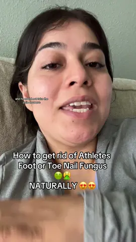 How to get rid of Athletes  Foot or Toe Nail Fungus 🤢🤮 NATURALLY 😍😍 #athletesfoot #toenails #nailfungus #fypage 