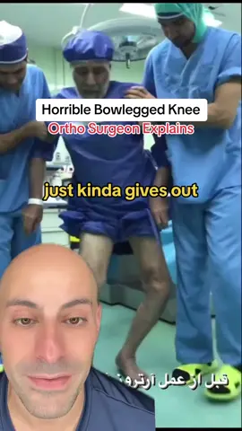 #kneepain #medical #doctor #LearnOnTikTok 
