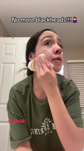 Want to get rid of your blackheads?? Click on the link above⬆️⬆️#ad #share #Tiktokshop #nosestrips #acne #blackheads